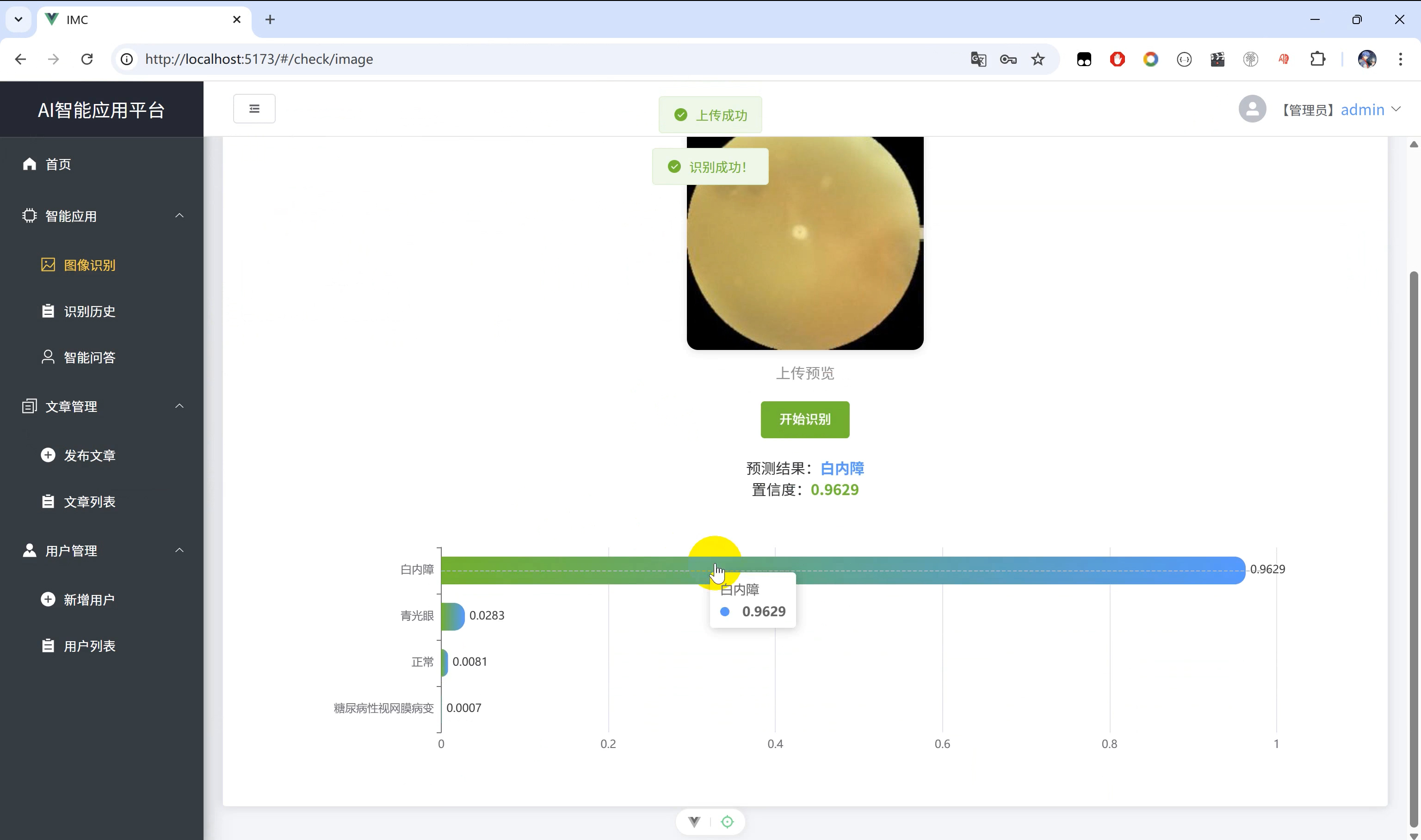 GitHub - ziwupython/eye_check_v3: 【眼疾识别系统】Python+TensorFlow+Vue3 ...